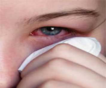 العين التهاب ملتحمة هل التهاب